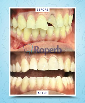 Roperb Dental Clinic