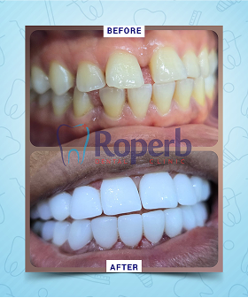 Roperb Dental Clinic