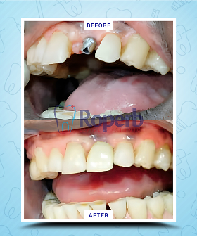 Roperb Dental Clinic