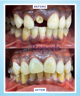 Roperb Dental Clinic