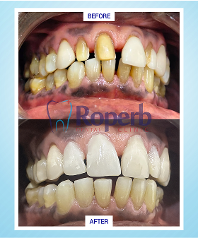 Roperb Dental Clinic