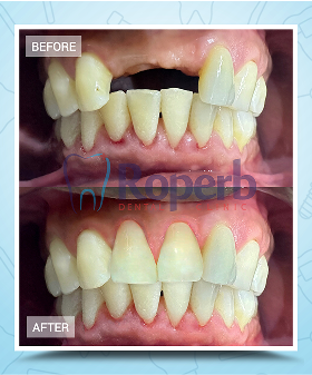 Roperb Dental Clinic