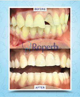 Roperb Dental Clinic