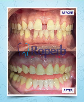Roperb Dental Clinic